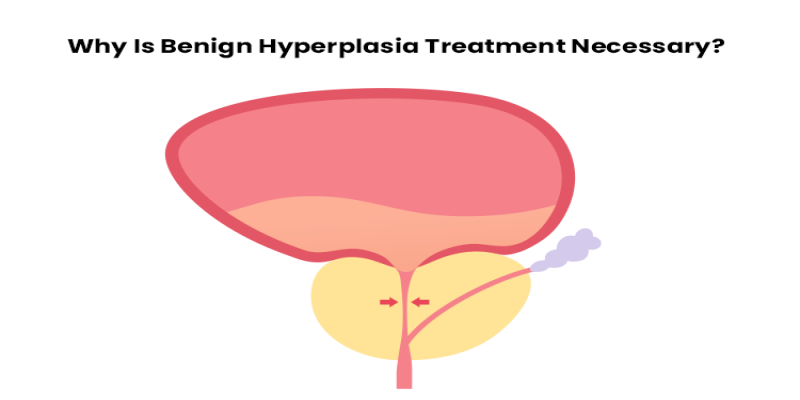 Why Is Benign Hyperplasia Treatment Necessary?