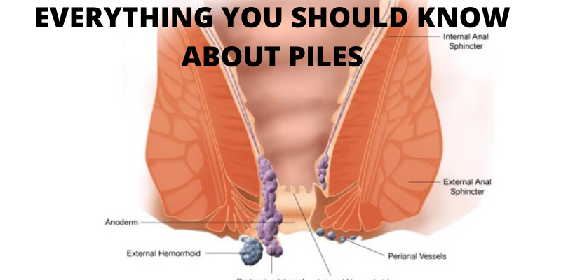 https://www.rghospitals.com/assets/media/800x400/EVERYTHING-YOU-SHOULD-KNOW-ABOUT-PILES.png