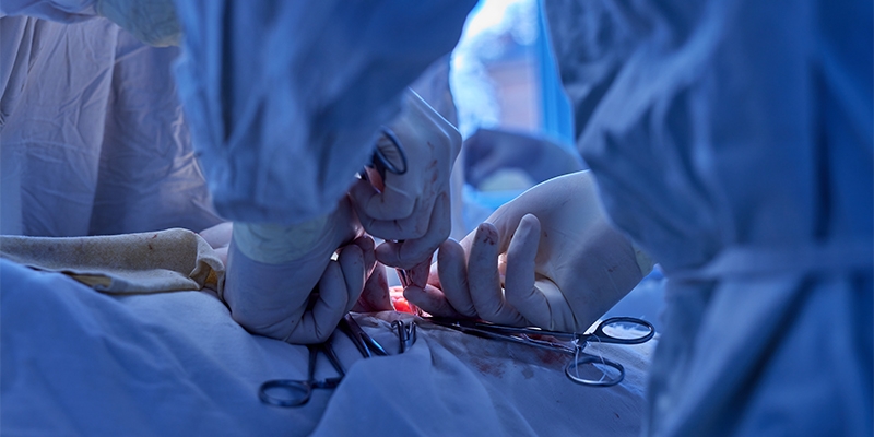 A Comprehensive Guide to Inguinal Hernia Surgery