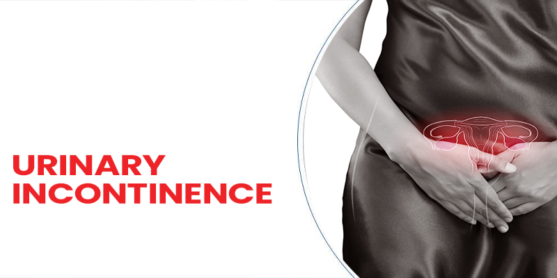 The Best Treatments for Urinary Incontinence in Elderly Women: A Comprehensive Guide