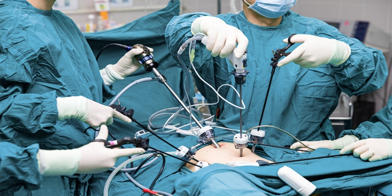 How to Find the Best Laparoscopic Surgeon: A Step-by-Step Guide